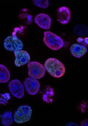 Fluorescence microscopy image of cells glowing in magenta and blue against a black background, with bright blue nuclei visible inside each cell.